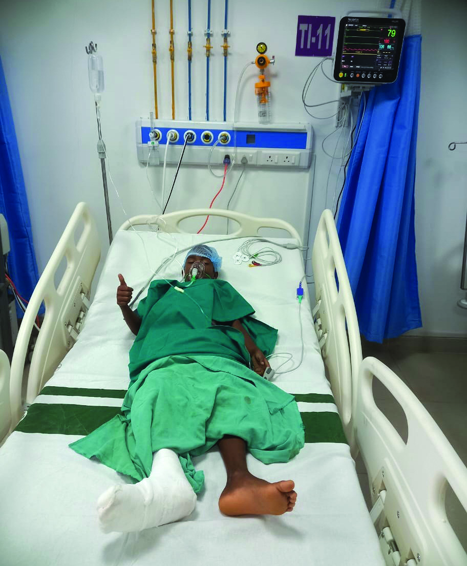 କେନ୍ଦୁଝର ମେଡିକାଲ କଲେଜ୍ ଟ୍ରମା କେୟାର ସେଣ୍ଟରରେ ପ୍ରଥମ ଅସ୍ଥିଶଲ୍ୟ ଅସ୍ତ୍ରୋପଚାର ସମ୍ପନ୍ନ